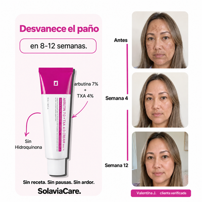 Crema Manchas