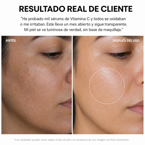 Suero vitamina C